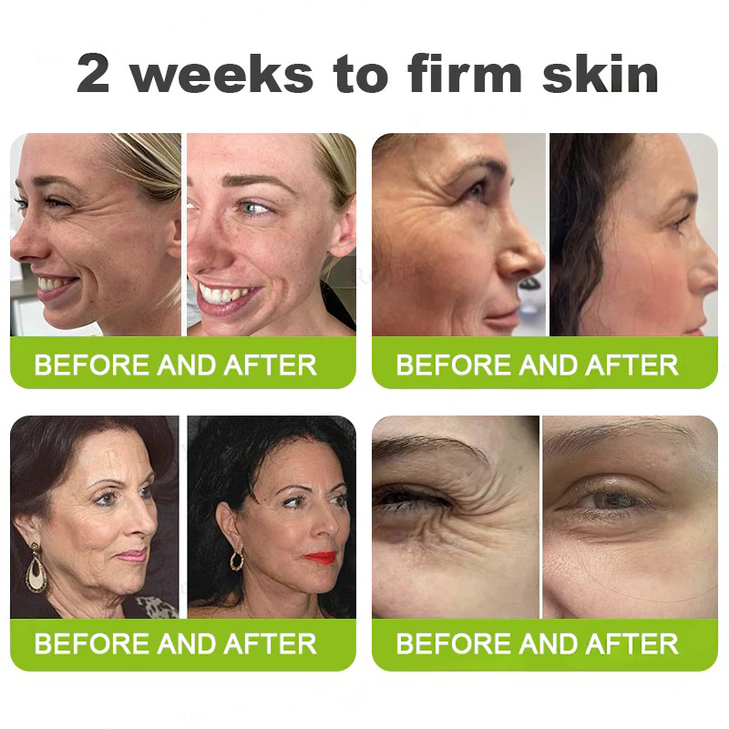 💫👨‍⚕️Made and shipped from the USA 💫Pureluxo® Botox & Vita-A Retinol Shot Wrinkle-Lift Tightening cream - Last Day Promotion 70% OFF
