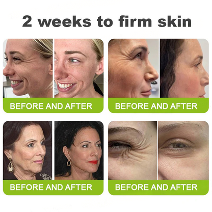 💫👨‍⚕️Made and shipped from the USA 💫Pureluxo® Botox & Vita-A Retinol Shot Wrinkle-Lift Tightening cream - Last Day Promotion 70% OFF