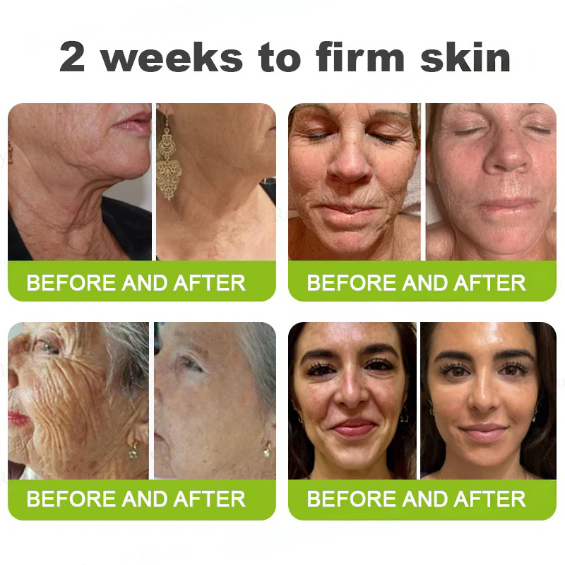 💫👨‍⚕️Made and shipped from the USA 💫Pureluxo® Botox & Vita-A Retinol Shot Wrinkle-Lift Tightening cream - Last Day Promotion 70% OFF