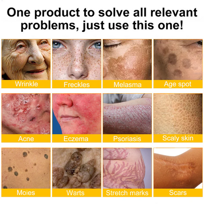 👨‍⚕️ Rolimey® Bee venom Pro Comprehensive Cream —Tightening for Skin Types 🎁
