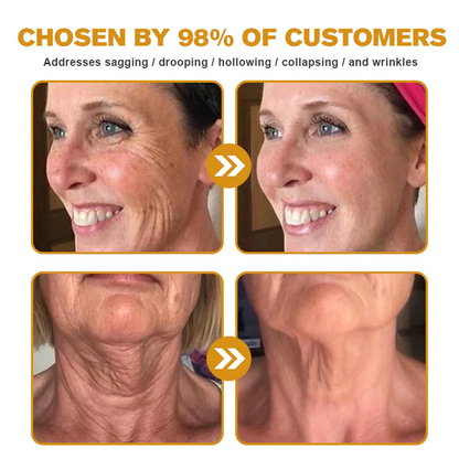 👨‍⚕️ Rolimey® Bee venom Pro Comprehensive Cream —Tightening for Skin Types 🎁