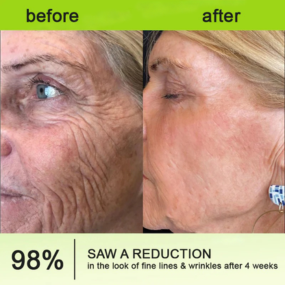 💫👨‍⚕️Made and shipped from the USA 💫Pureluxo® Botox & Vita-A Retinol Shot Wrinkle-Lift Tightening cream - Last Day Promotion 70% OFF