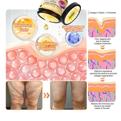 👨‍⚕️ Rolimey® Bee venom Pro Comprehensive Cream —Tightening for Skin Types 🎁