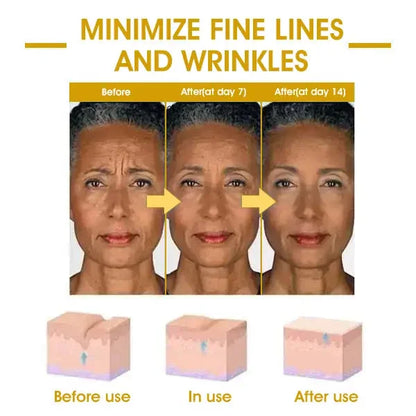 Last Day Sale: 70% OFF 💧 TLOPA® SkinFirming Rejuvenating serum 💧