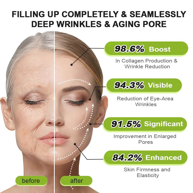 💫👨‍⚕️Made and shipped from the USA 💫Pureluxo® Botox & Vita-A Retinol Shot Wrinkle-Lift Tightening cream - Last Day Promotion 70% OFF