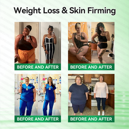 [👩‍⚕️FDA-Registered & GMP Certified]|𝙋𝙪𝙧𝙚𝙡𝙪𝙭𝙤® 𝑴𝒐𝒓𝒊𝒏𝒈𝒂 & 𝑩𝒆𝒓𝒃𝒆𝒓𝒊𝒏𝒆 NAD+| Slimming & Firming 2-in-1 Nano Microneedle Patch🇺🇸|𝘉𝘢𝘤𝘬𝘦𝘥 𝘣𝘺 𝘴𝘤𝘪𝘦𝘯𝘤𝘦 | 10-𝗂𝗇-𝟣 𝖿𝗈𝗋𝗆𝗎𝗅𝖺 | 𝑅𝑒𝑠𝑢𝑙𝑡𝑠 𝑖𝑛 7 𝑑𝑎𝑦𝑠 ✅