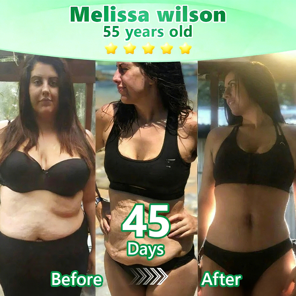[👩‍⚕️FDA-Registered & GMP Certified]|𝙋𝙪𝙧𝙚𝙡𝙪𝙭𝙤® 𝑴𝒐𝒓𝒊𝒏𝒈𝒂 & 𝑩𝒆𝒓𝒃𝒆𝒓𝒊𝒏𝒆 NAD+| Slimming & Firming 2-in-1 Nano Microneedle Patch🇺🇸|𝘉𝘢𝘤𝘬𝘦𝘥 𝘣𝘺 𝘴𝘤𝘪𝘦𝘯𝘤𝘦 | 10-𝗂𝗇-𝟣 𝖿𝗈𝗋𝗆𝗎𝗅𝖺 | 𝑅𝑒𝑠𝑢𝑙𝑡𝑠 𝑖𝑛 7 𝑑𝑎𝑦𝑠 ✅