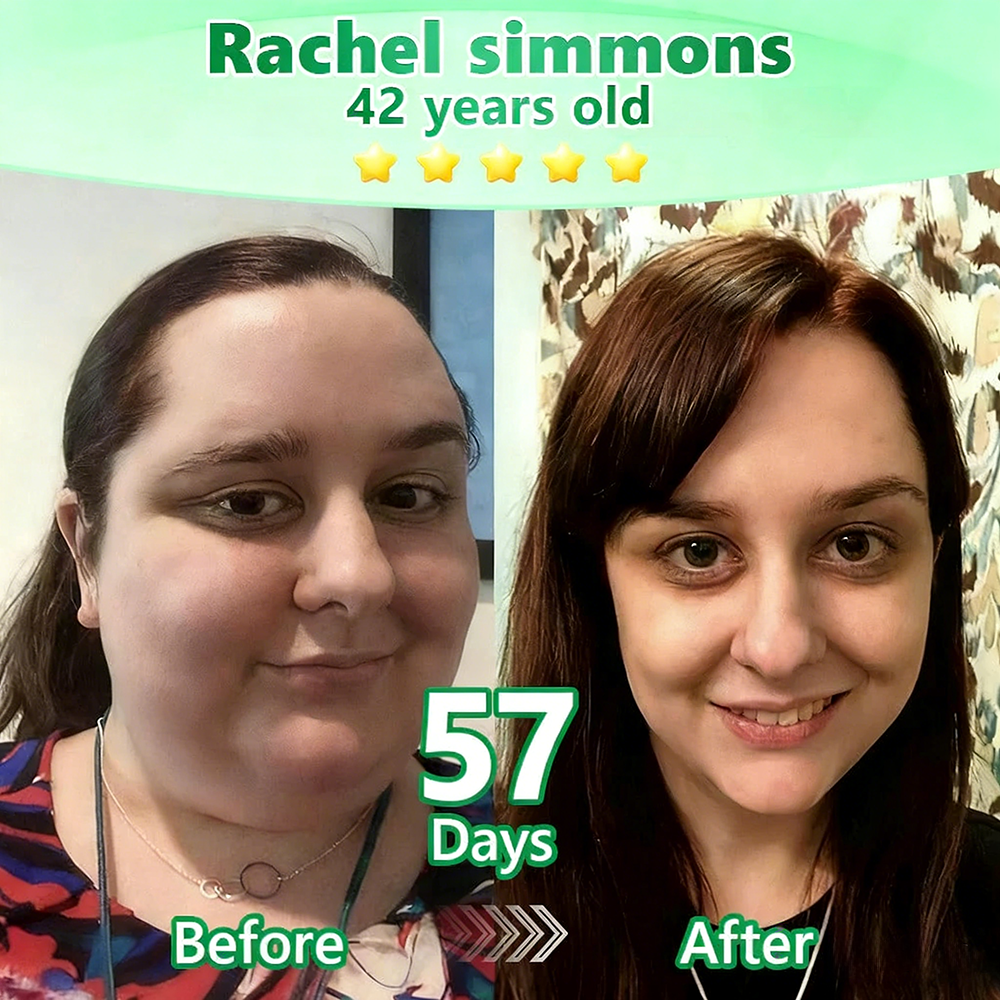 [👩‍⚕️FDA-Registered & GMP Certified]|𝙋𝙪𝙧𝙚𝙡𝙪𝙭𝙤® 𝑴𝒐𝒓𝒊𝒏𝒈𝒂 & 𝑩𝒆𝒓𝒃𝒆𝒓𝒊𝒏𝒆 NAD+| Slimming & Firming 2-in-1 Nano Microneedle Patch🇺🇸|𝘉𝘢𝘤𝘬𝘦𝘥 𝘣𝘺 𝘴𝘤𝘪𝘦𝘯𝘤𝘦 | 10-𝗂𝗇-𝟣 𝖿𝗈𝗋𝗆𝗎𝗅𝖺 | 𝑅𝑒𝑠𝑢𝑙𝑡𝑠 𝑖𝑛 7 𝑑𝑎𝑦𝑠 ✅