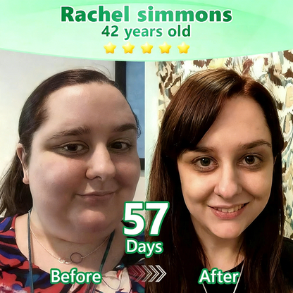 [👩‍⚕️FDA-Registered & GMP Certified]|𝙋𝙪𝙧𝙚𝙡𝙪𝙭𝙤® 𝑴𝒐𝒓𝒊𝒏𝒈𝒂 & 𝑩𝒆𝒓𝒃𝒆𝒓𝒊𝒏𝒆 NAD+| Slimming & Firming 2-in-1 Nano Microneedle Patch🇺🇸|𝘉𝘢𝘤𝘬𝘦𝘥 𝘣𝘺 𝘴𝘤𝘪𝘦𝘯𝘤𝘦 | 10-𝗂𝗇-𝟣 𝖿𝗈𝗋𝗆𝗎𝗅𝖺 | 𝑅𝑒𝑠𝑢𝑙𝑡𝑠 𝑖𝑛 7 𝑑𝑎𝑦𝑠 ✅