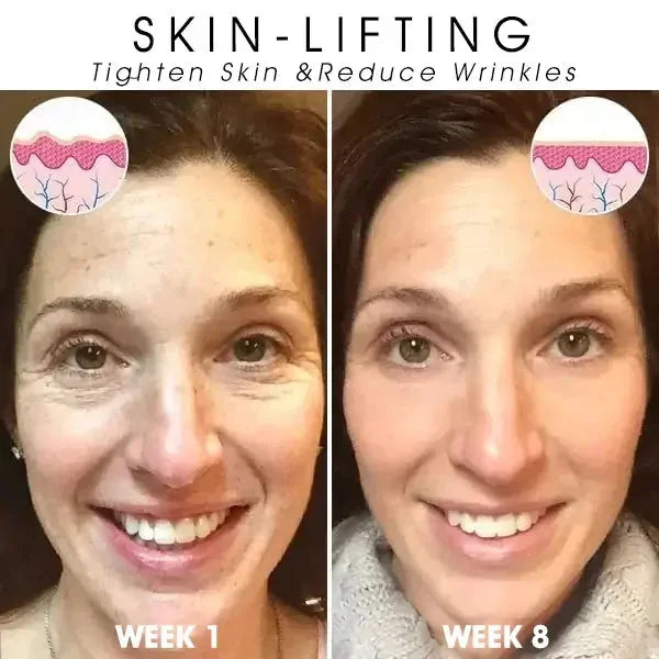 Last Day Sale: 70% OFF 💧 TLOPA® SkinFirming Rejuvenating serum 💧
