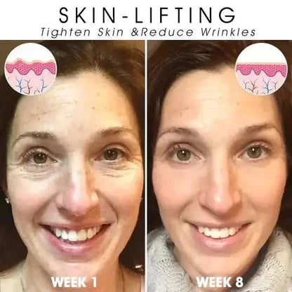 Last Day Sale: 70% OFF 💧 TLOPA® SkinFirming Rejuvenating serum 💧