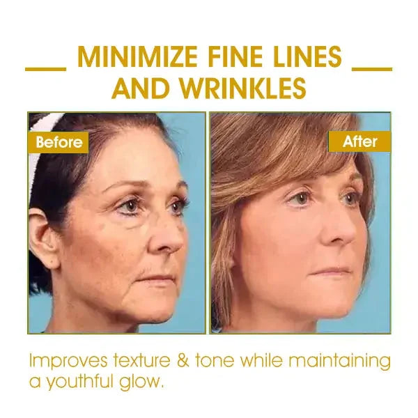 Last Day Sale: 70% OFF 💧 TLOPA® SkinFirming Rejuvenating serum 💧