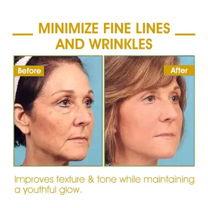 Last Day Sale: 70% OFF 💧 TLOPA® SkinFirming Rejuvenating serum 💧