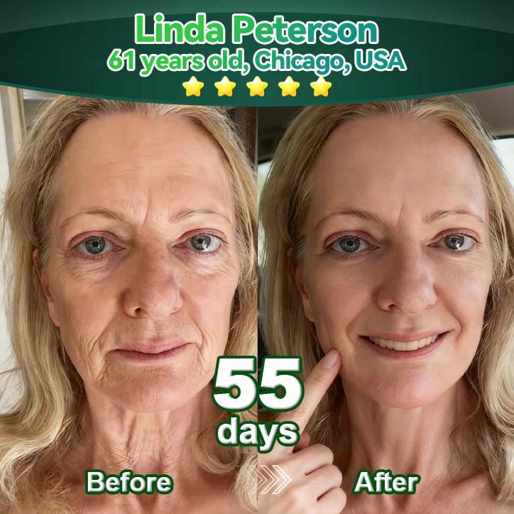 【𝐿𝑎𝑠𝑡 𝐷𝑎𝑦 𝑃𝑟𝑜𝑚𝑜𝑡𝑖𝑜𝑛 70% 𝑂𝐹𝐹】𝑷𝒖𝒓𝒆𝒍𝒖𝒙𝒐® ✨ Stem Cell–Inspired & GHK-Cu Powered Wrinkle-Refining Serum（Advanced Anti-Aging for Timeless, Radiant Skin）