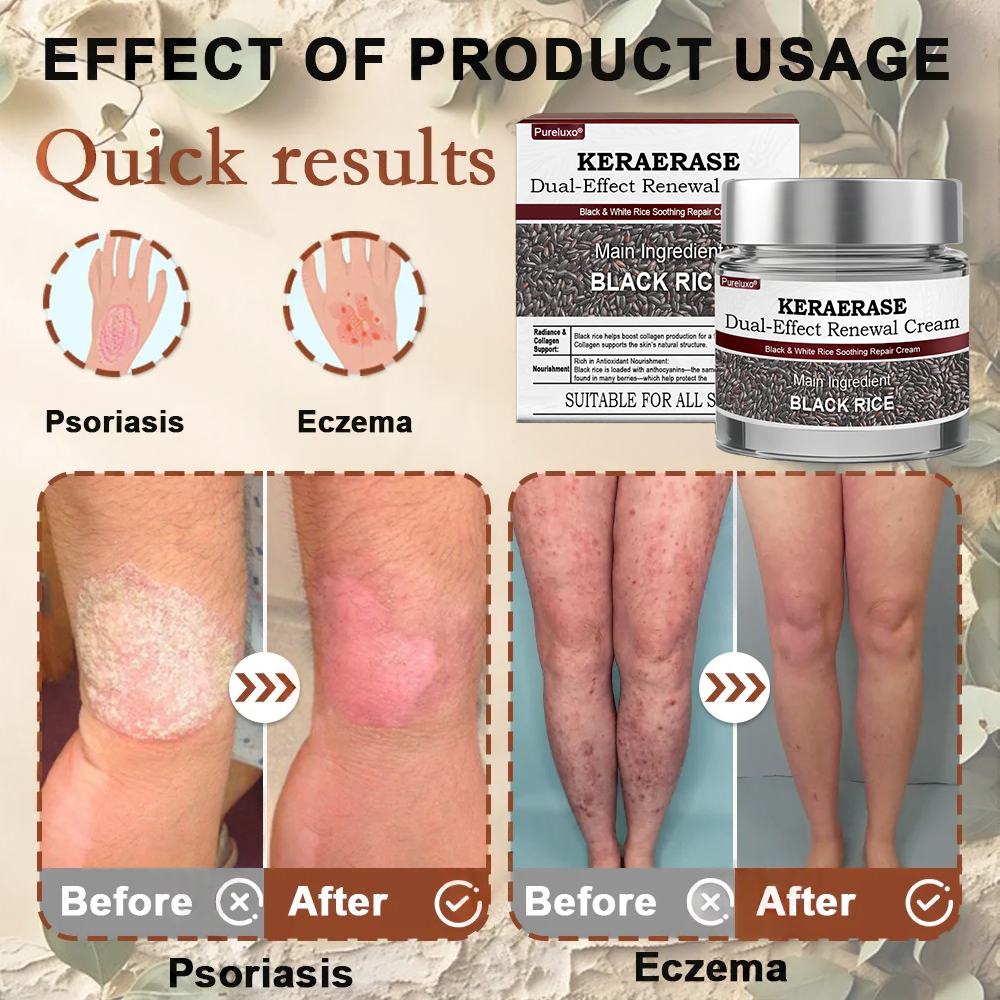 Pureluxo® KeraErase Dual-Action Renewal Cream ✨