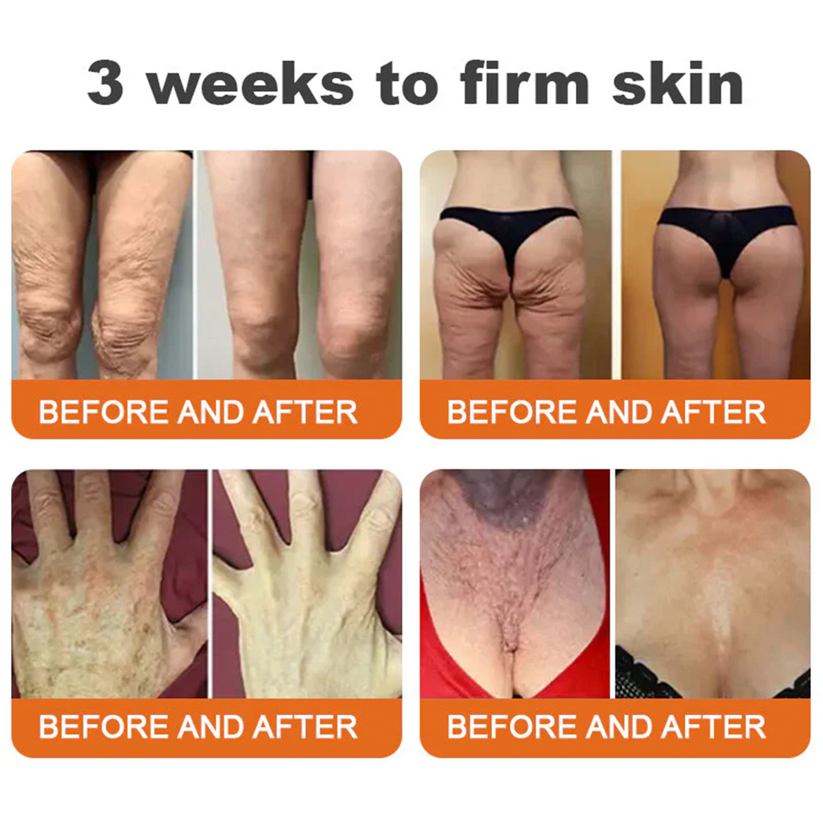 👨‍⚕️ Rolimey® Bee venom Pro Comprehensive Cream —Tightening for Skin Types 🎁