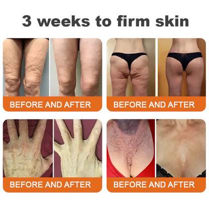 👨‍⚕️ Rolimey® Bee venom Pro Comprehensive Cream —Tightening for Skin Types 🎁