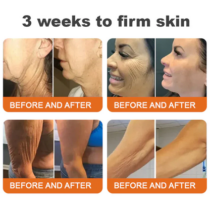 👨‍⚕️ Rolimey® Bee venom Pro Comprehensive Cream —Tightening for Skin Types 🎁