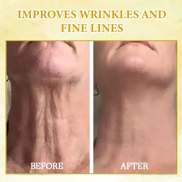 Last Day Sale: 70% OFF 💧 TLOPA® SkinFirming Rejuvenating serum 💧