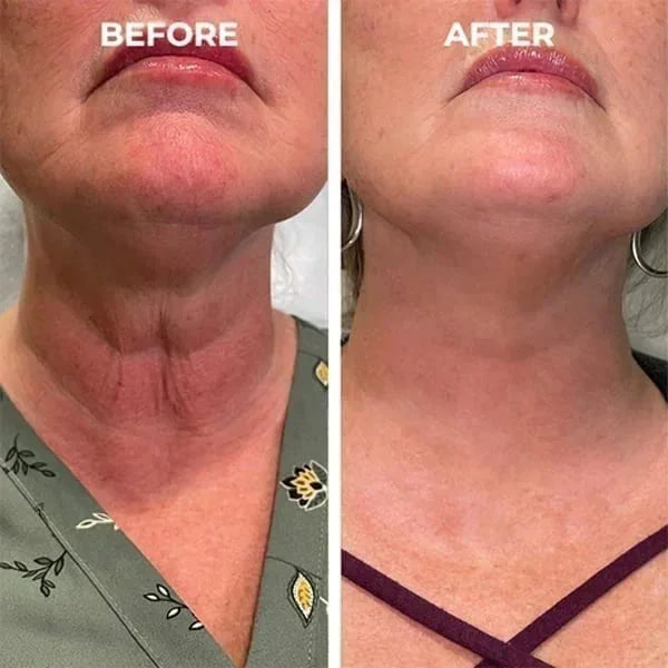 Last Day Sale: 70% OFF 💧 TLOPA® SkinFirming Rejuvenating serum 💧