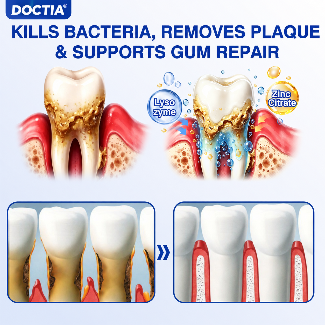 🇺🇸🏅🦷🛡️ DOCTIA® GumRevive Advanced Gum Care & Repair Gel 🚚
