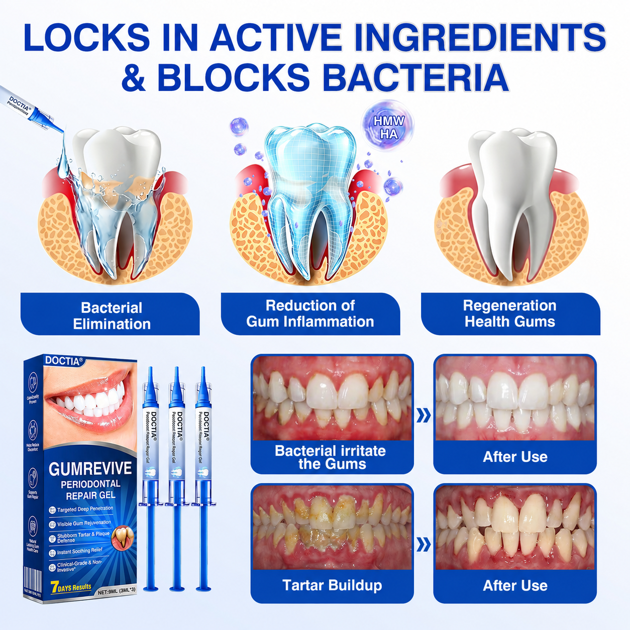 🇺🇸🏅🦷🛡️ DOCTIA® GumRevive Advanced Gum Care & Repair Gel 🚚