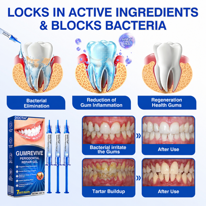🇺🇸🏅🦷🛡️ DOCTIA® GumRevive Advanced Gum Care & Repair Gel 🚚