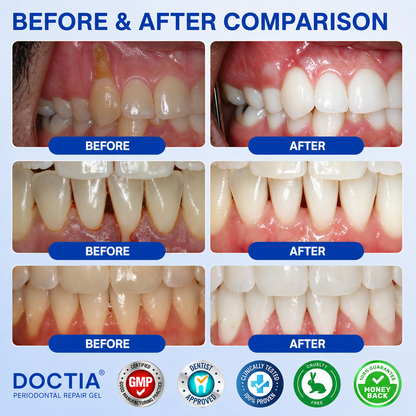 🇺🇸🏅🦷🛡️ DOCTIA® GumRevive Advanced Gum Care & Repair Gel 🚚