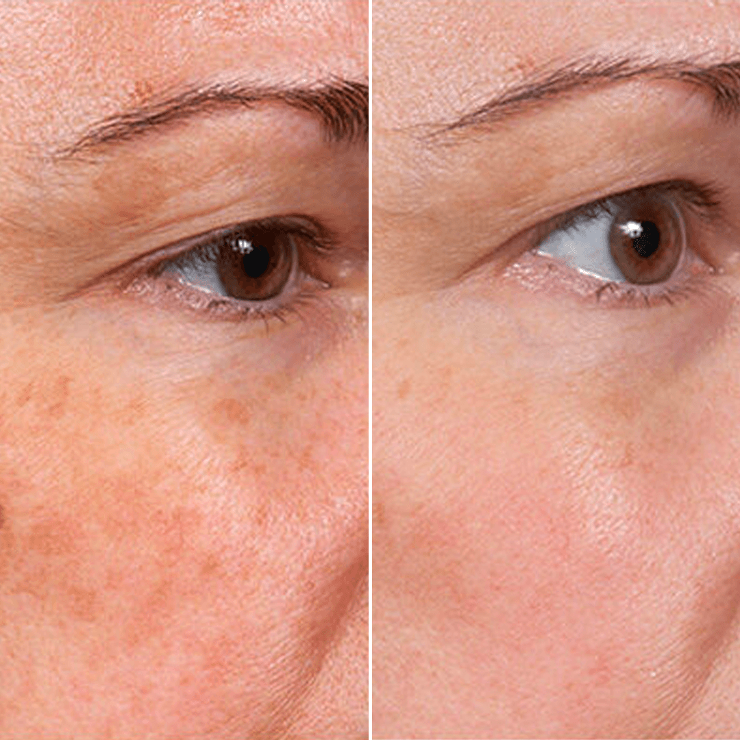 【𝐿𝑎𝑠𝑡 𝐷𝑎𝑦 𝑃𝑟𝑜𝑚𝑜𝑡𝑖𝑜𝑛 70% 𝑂𝐹𝐹】𝑷𝒖𝒓𝒆𝒍𝒖𝒙𝒐® ✨ Stem Cell–Inspired & GHK-Cu Powered Wrinkle-Refining Serum（Advanced Anti-Aging for Timeless, Radiant Skin）