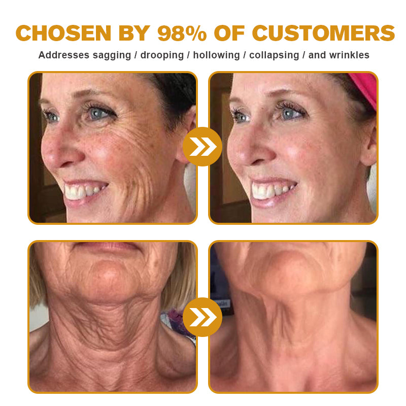 (Made and Shipped from USA) 🧑‍⚕️Pureluxo® Botox Bee Venom Wrinkle Removal Cream- LAST DAY 70% OFF✨