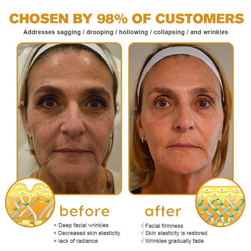 (Made and Shipped from USA) 🧑‍⚕️Pureluxo® Botox Bee Venom Wrinkle Removal Cream- LAST DAY 70% OFF✨