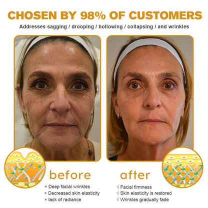 (Made and Shipped from USA) 🧑‍⚕️Pureluxo® Botox Bee Venom Wrinkle Removal Cream- LAST DAY 70% OFF✨